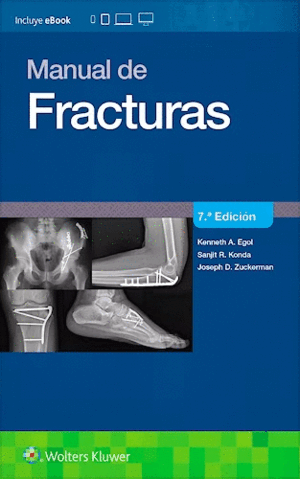 MANUAL DE FRACTURAS. 7ª ED.