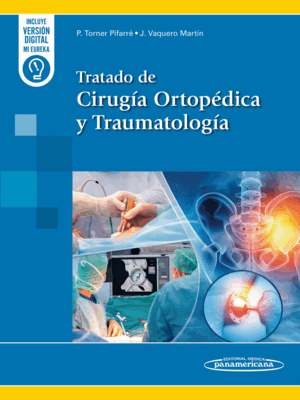 TRATADO DE CIRUGÍA ORTOPÉDICA Y TRAUMATOLOGÍA