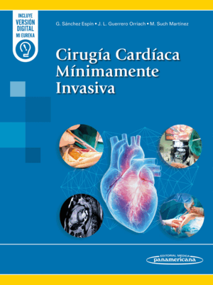 CIRUGÍA CARDIACA MÍNIMAMENTE INVASIVA