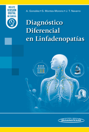DIAGNÓSTICO DIFERENCIAL EN LINFADENOPATÍAS