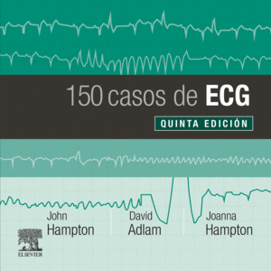 150 CASOS DE ECG. 5ª ED.