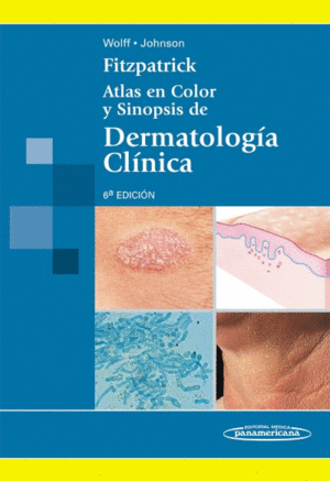FITZPATRICK: ATLAS EN COLOR Y SINOPSIS DE DERMATOLOGÍA CLÍNICA. 6ª ED.