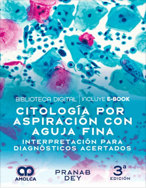 CITOLOGÍA POR ASPIRACIÓN CON AGUJA FINA