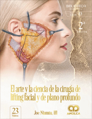 EL ARTE Y LA CIENCIA DE LA CIRUGÍA DE LIFTING FACIAL Y DE PLANO PROFUNDO. 2ª ED.