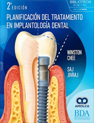 PLANIFICACIÓN DEL TRATAMIENTO EN IMPLANTOLOGÍA DENTAL