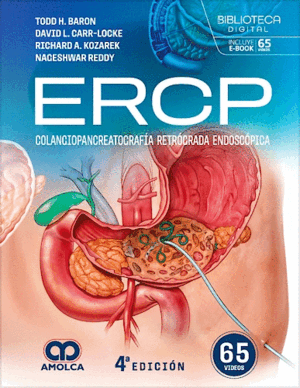 ERCP. COLANGIOPANCREATOGRAFÍA RETRÓGRADA ENDOSCÓPICA. 4ª ED.