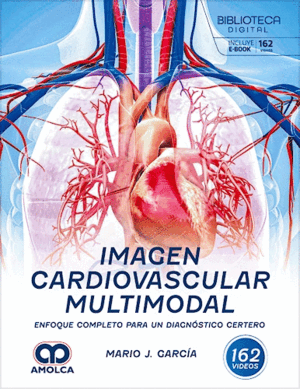 IMAGEN CARDIOVASCULAR MULTIMODAL